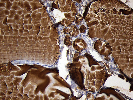 TG Antibody in Immunohistochemistry (Paraffin) (IHC (P))