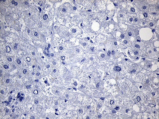 TG Antibody in Immunohistochemistry (Paraffin) (IHC (P))