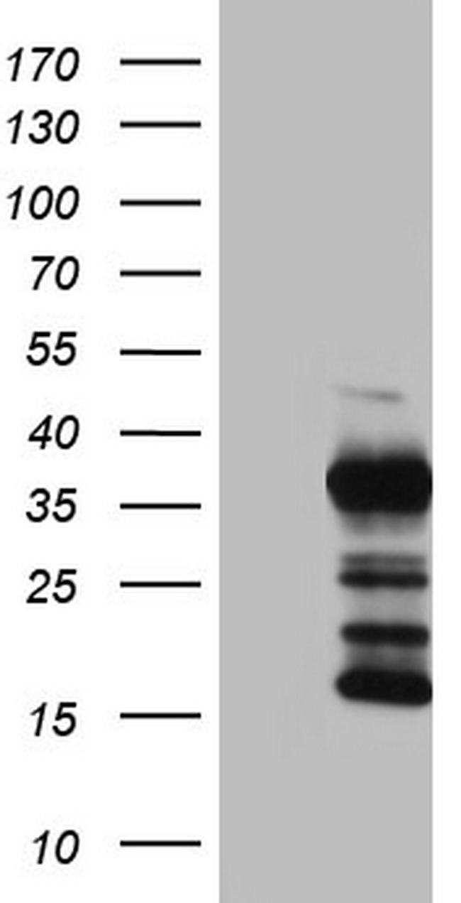 TG Antibody in Western Blot (WB)