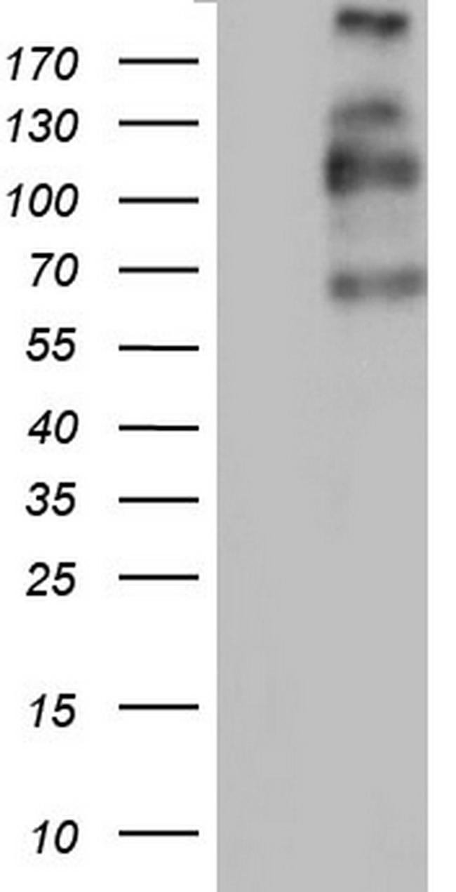 TG Antibody in Western Blot (WB)