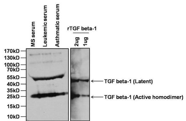 TGF beta-1 Antibody in Western Blot (WB)