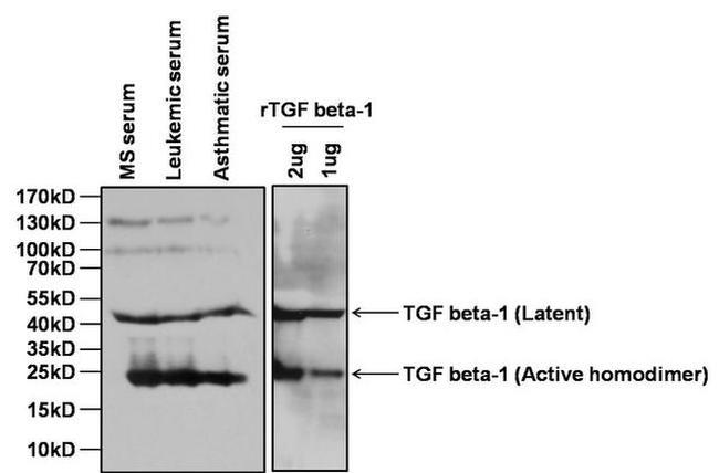 TGF beta-1 Antibody in Western Blot (WB)