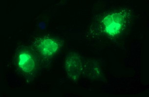 TGFB1 Antibody in Immunocytochemistry (ICC/IF)