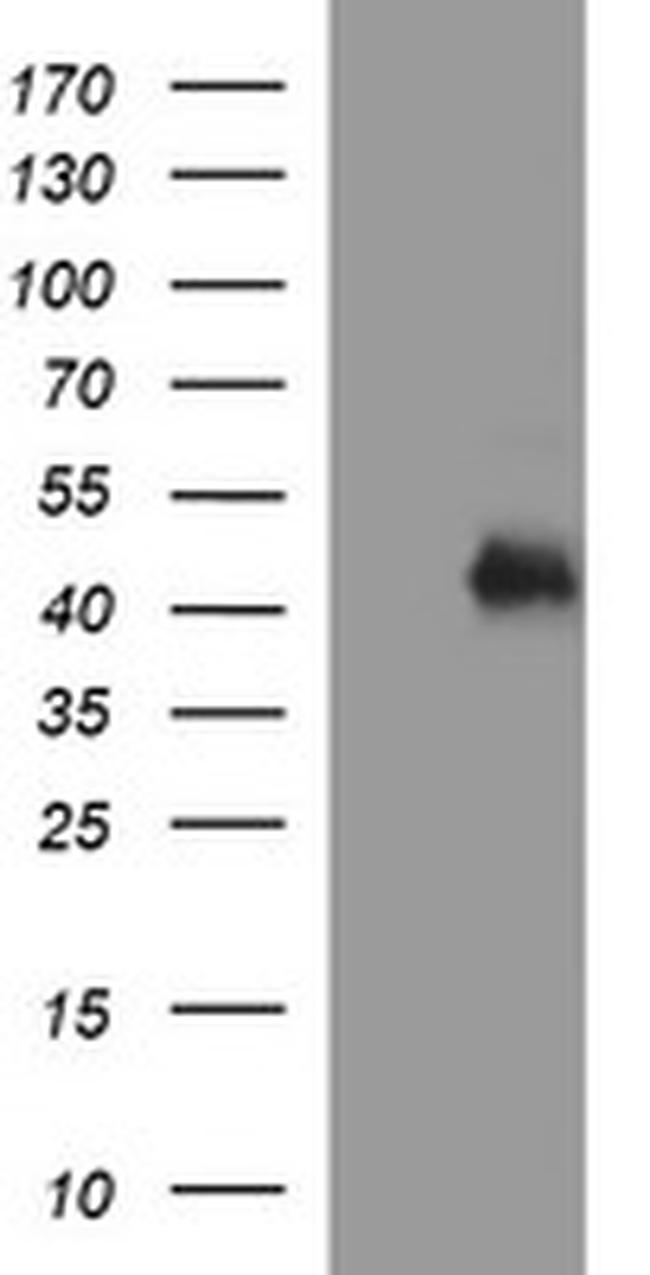 TGFB1 Antibody in Western Blot (WB)