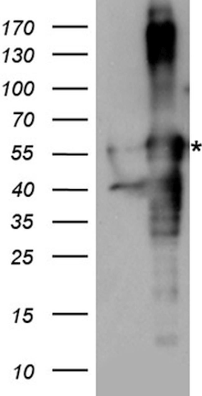 TGFB1I1 Antibody in Western Blot (WB)