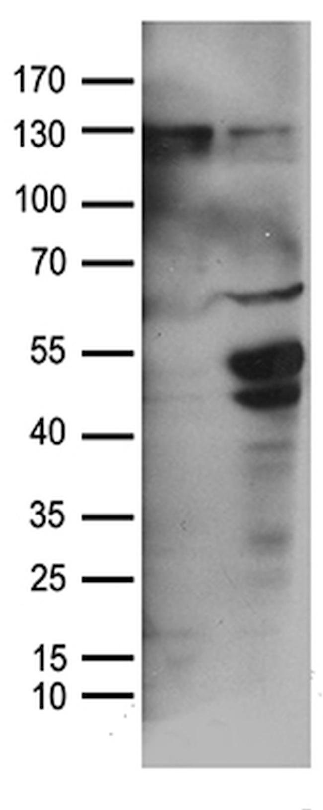 TGFB2 Antibody in Western Blot (WB)