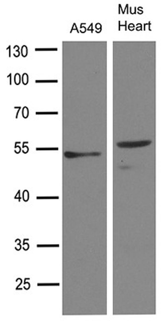 TGFB2 Antibody in Western Blot (WB)