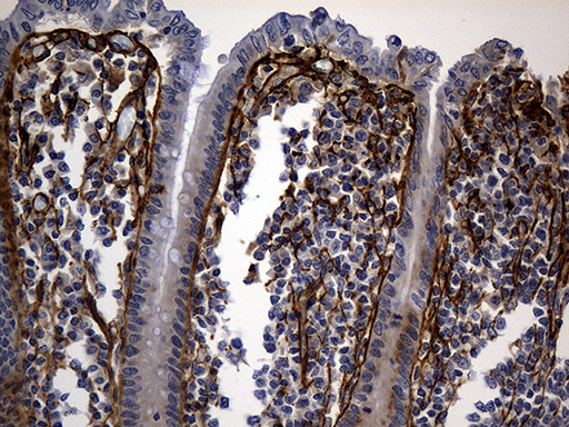 TGFBI Antibody in Immunohistochemistry (Paraffin) (IHC (P))