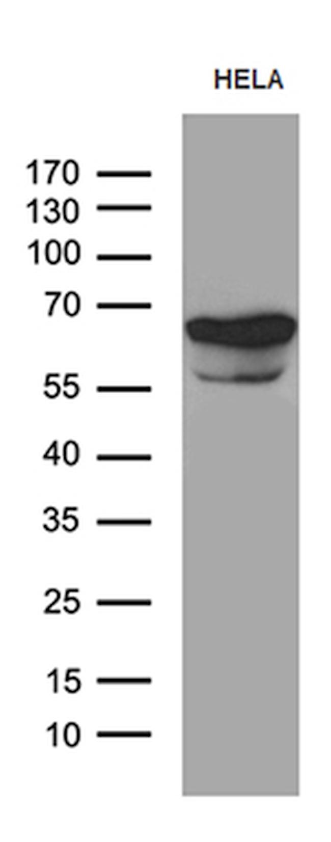 TGFBI Antibody in Western Blot (WB)