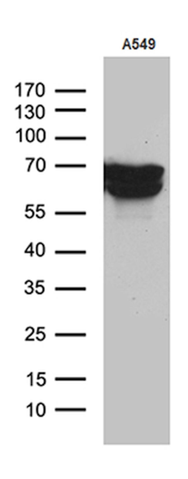 TGFBI Antibody in Western Blot (WB)