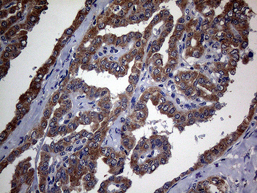 TGFBR2 Antibody in Immunohistochemistry (Paraffin) (IHC (P))