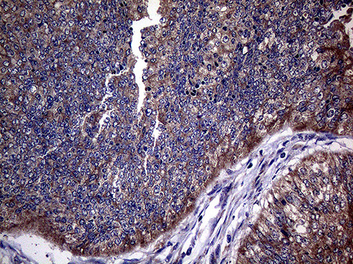 TGFBR2 Antibody in Immunohistochemistry (Paraffin) (IHC (P))