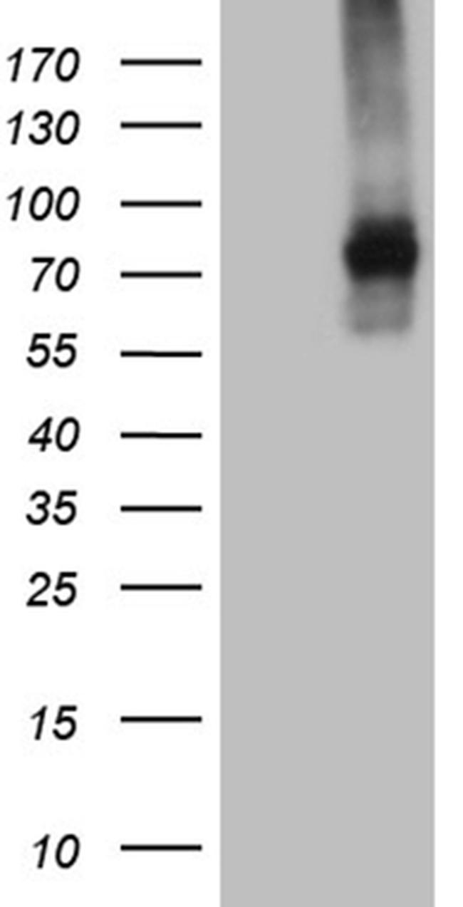 TGFBR2 Antibody in Western Blot (WB)