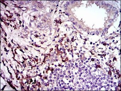 LAP (Latency Associated Peptide) Antibody in Immunohistochemistry (Paraffin) (IHC (P))