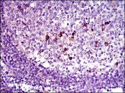 LAP (Latency Associated Peptide) Antibody in Immunohistochemistry (Paraffin) (IHC (P))