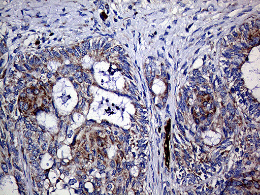 TGM2 Antibody in Immunohistochemistry (Paraffin) (IHC (P))