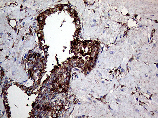 TGM2 Antibody in Immunohistochemistry (Paraffin) (IHC (P))