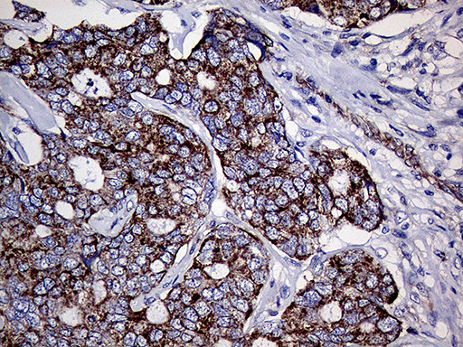 TGM2 Antibody in Immunohistochemistry (Paraffin) (IHC (P))