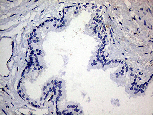 TGM2 Antibody in Immunohistochemistry (Paraffin) (IHC (P))