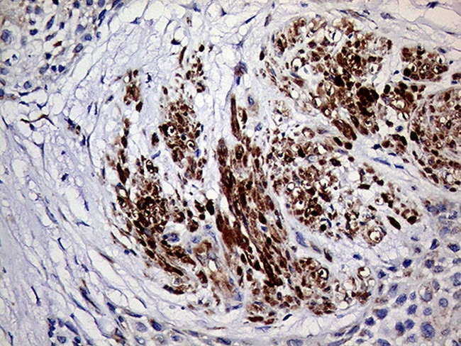 TGM2 Antibody in Immunohistochemistry (Paraffin) (IHC (P))