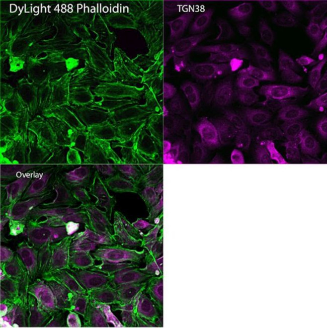 TGN46 Antibody in Immunocytochemistry (ICC/IF)