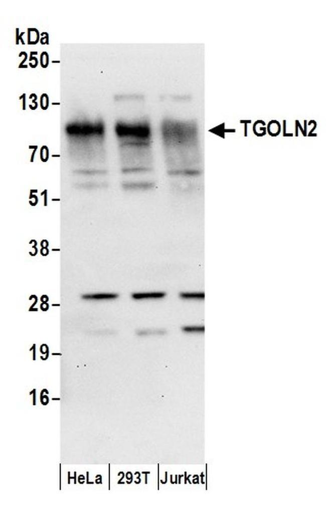 TGOLN2 Antibody in Western Blot (WB)