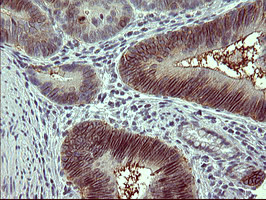 TH Antibody in Immunohistochemistry (Paraffin) (IHC (P))