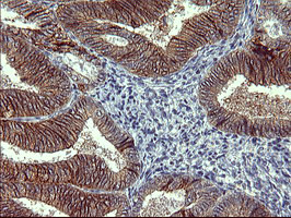 TH Antibody in Immunohistochemistry (Paraffin) (IHC (P))