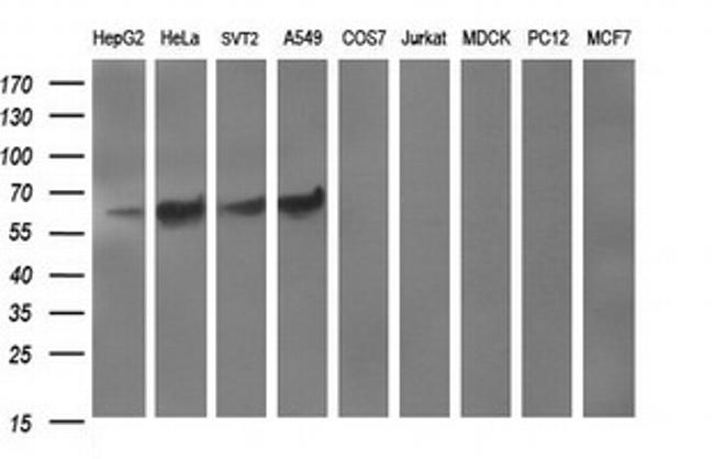 TH Antibody in Western Blot (WB)