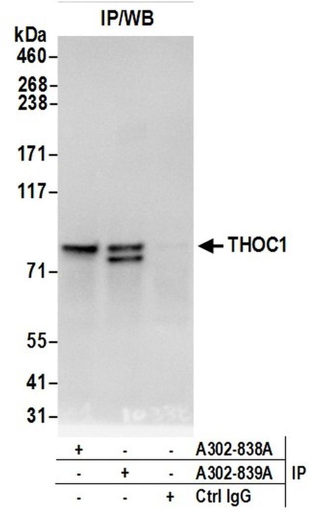 THOC1 Antibody in Western Blot (WB)