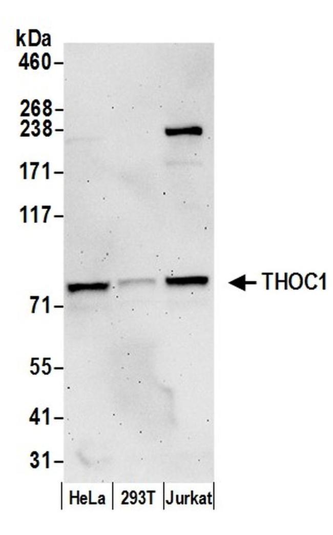 THOC1 Antibody in Western Blot (WB)