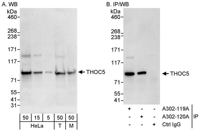 THOC5 Antibody in Western Blot (WB)