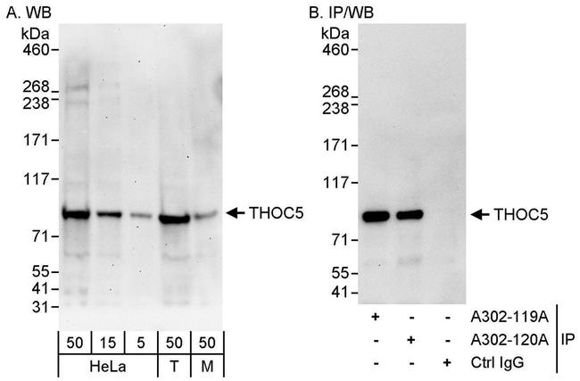 THOC5 Antibody in Western Blot (WB)