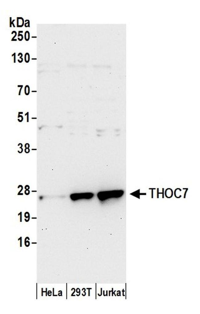 THOC7 Antibody in Western Blot (WB)