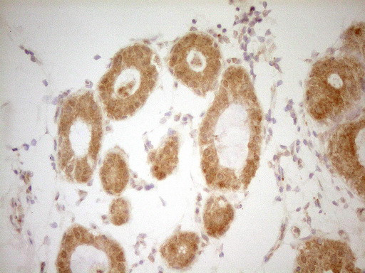 THRA Antibody in Immunohistochemistry (Paraffin) (IHC (P))