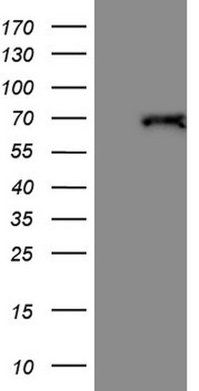 THRA Antibody in Western Blot (WB)