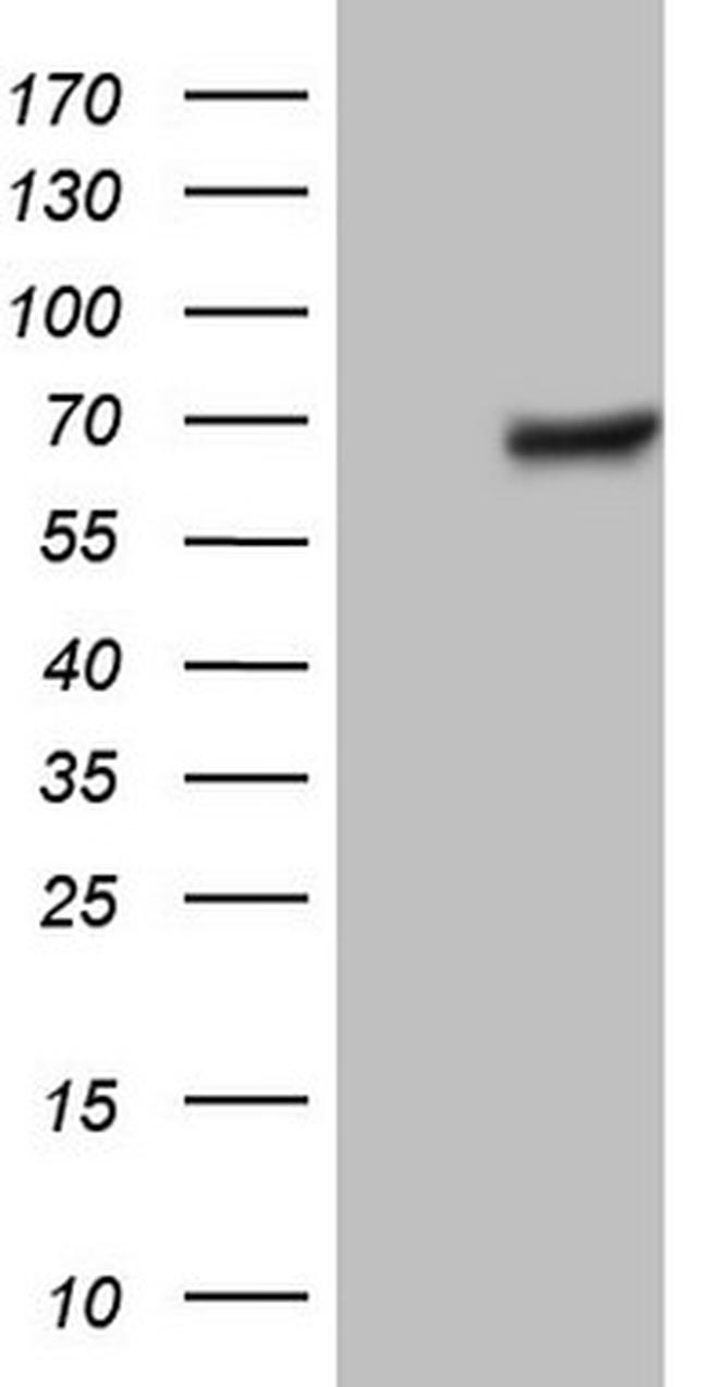 THRA Antibody in Western Blot (WB)