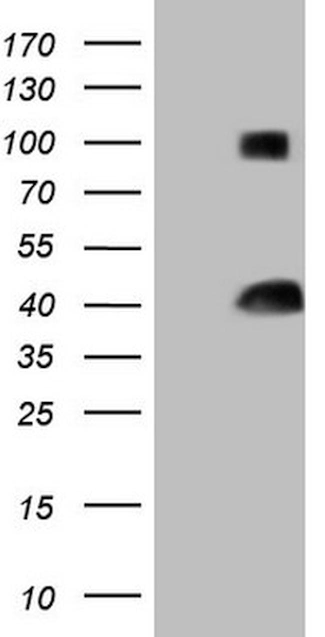 THTPA Antibody in Western Blot (WB)