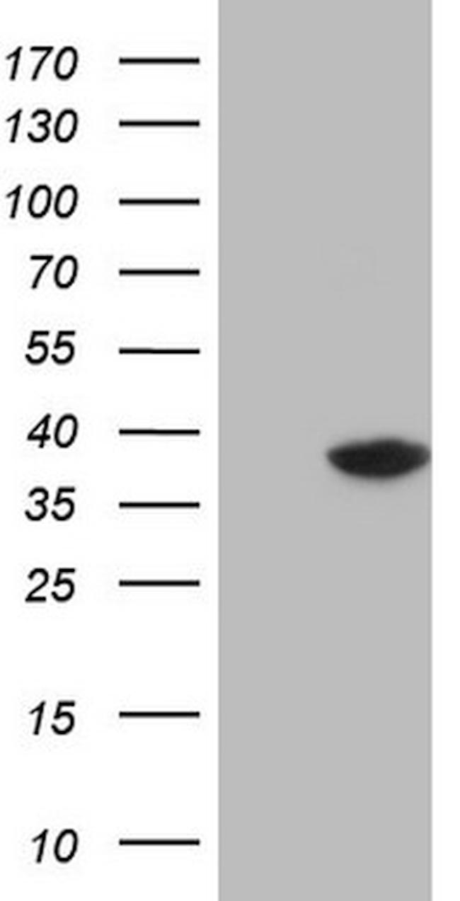 THTPA Antibody in Western Blot (WB)