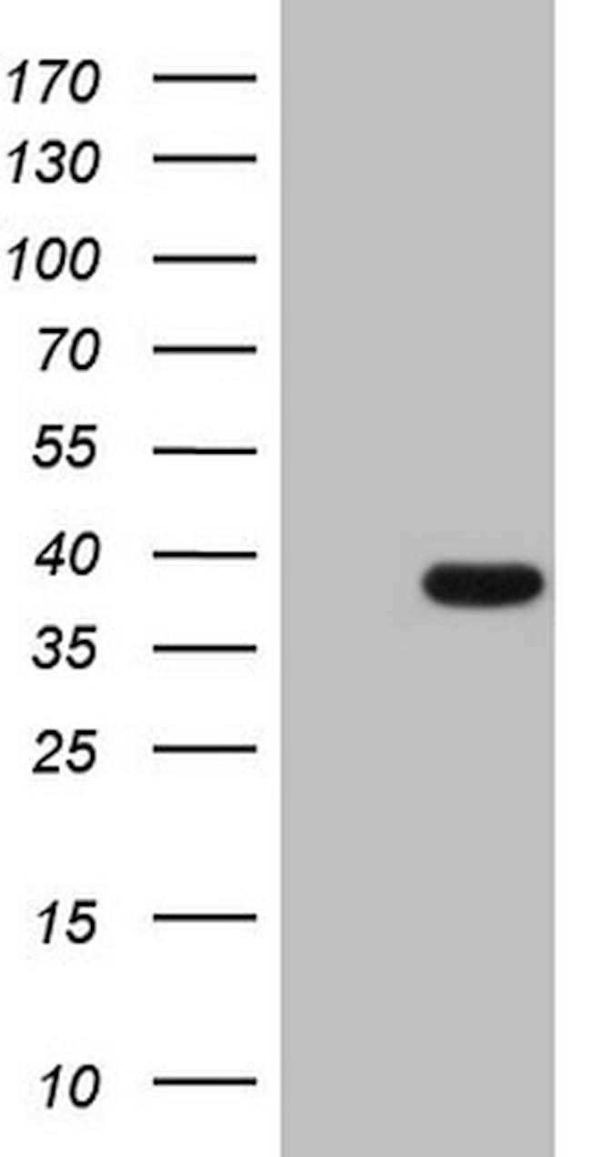 THTPA Antibody in Western Blot (WB)