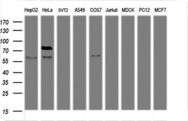 TICAM1 Antibody in Western Blot (WB)