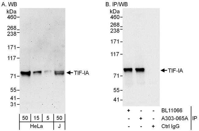 TIF-IA Antibody in Western Blot (WB)