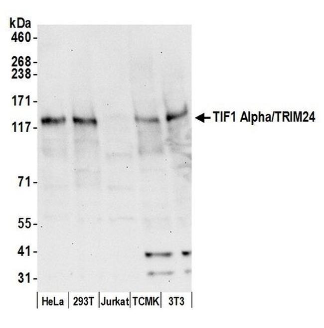 TIF1 Alpha/TRIM24 Antibody in Western Blot (WB)