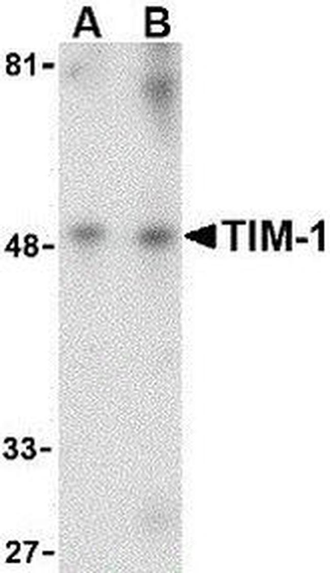 TIM-1 Antibody in Western Blot (WB)