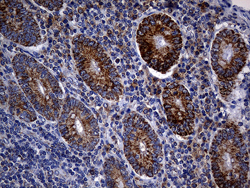 TIMM23 Antibody in Immunohistochemistry (Paraffin) (IHC (P))