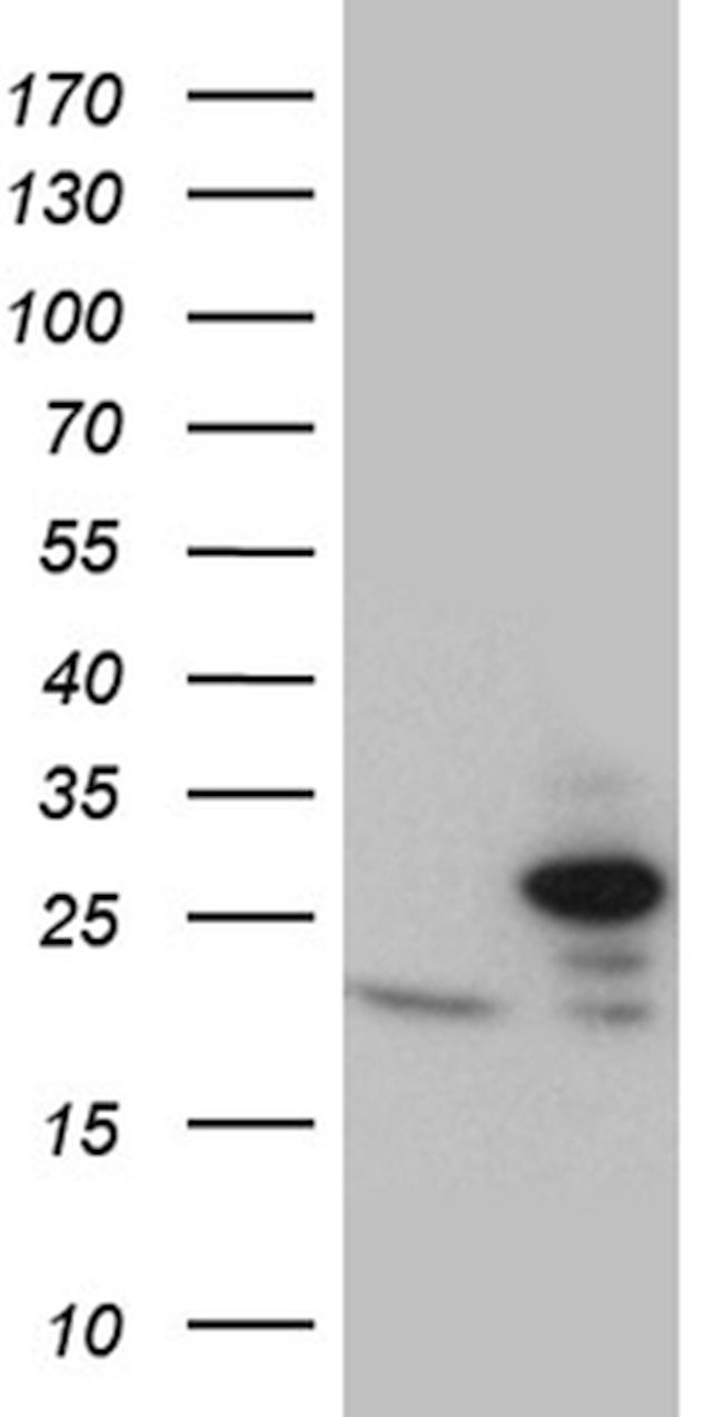 TIMM23 Antibody in Western Blot (WB)