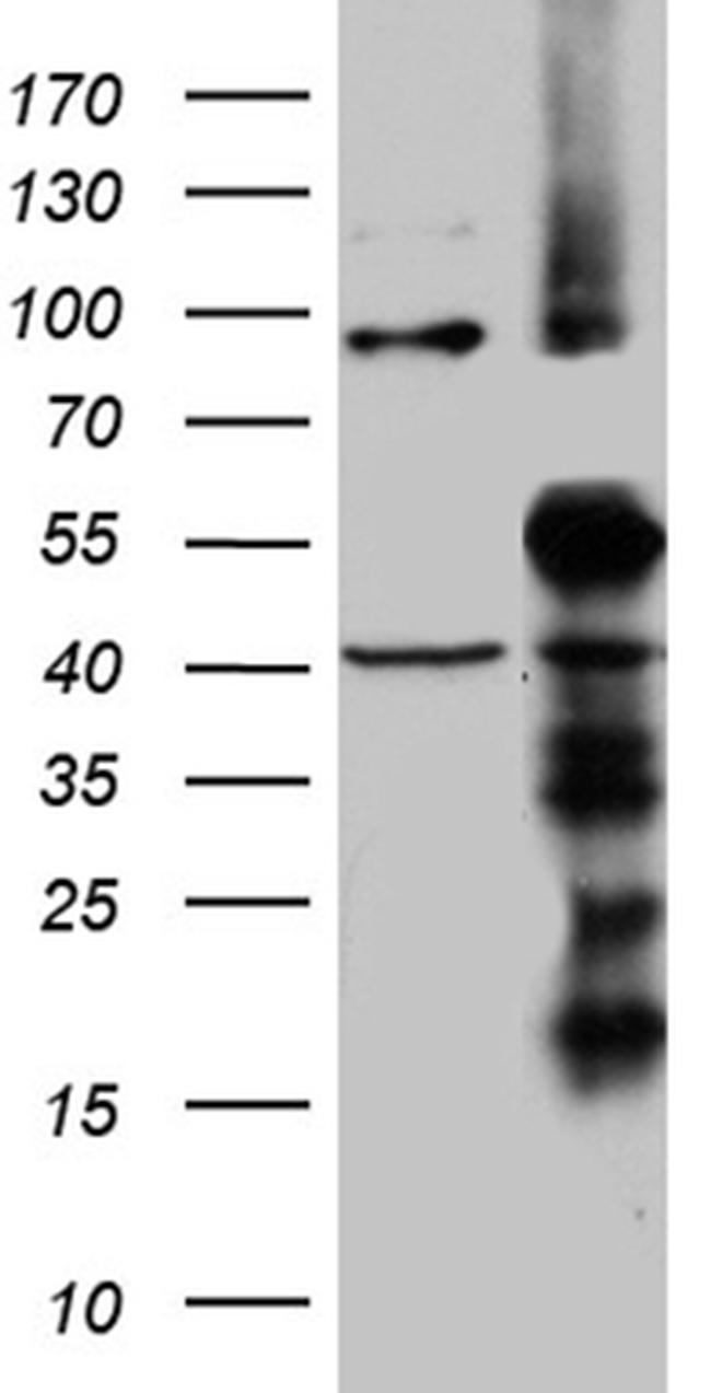 TIMM50 Antibody in Western Blot (WB)