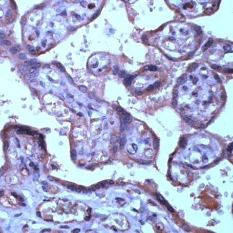 TIMP3 Antibody in Immunohistochemistry (Paraffin) (IHC (P))