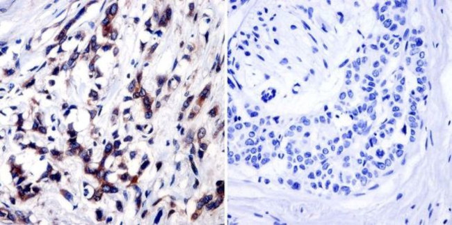 TIMP1 Antibody in Immunohistochemistry (Paraffin) (IHC (P))