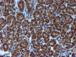 TIMP2 Antibody in Immunohistochemistry (Paraffin) (IHC (P))